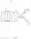Fig. 07 - Portable Circular Knitting Needle Holder Kit
