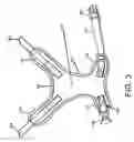 Fig. 04 - Non-choking harness for pet