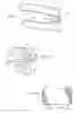 Fig. 02 - Oral appliance for treating a breathing condition
