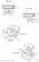 Fig. 04 - Oral appliance for treating a breathing condition