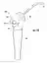 Fig. 03 - Dental syringe