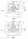 Fig. 26 - Dental syringe