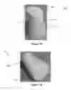 Fig. 02 - Hybrid Closure For Containers