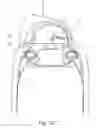 Fig. 22 - Spray actuator