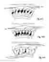 Fig. 06 - Rigid-buckling-resistant-fluted paperboard container with arcuate outer region