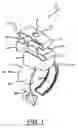 Fig. 02 - Pipe hanger