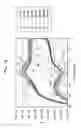 Fig. 13 - Molecular device, imaging device, photosensor, and electronic apparatus