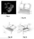 Fig. 03 - Wireless resonant magnetic acutation for untethered microrobots