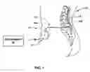 Fig. 02 - Management of session history data for implantable fluid delivery device