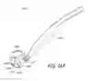Fig. 26 - Gonioscope for improved viewing