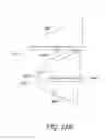Fig. 29 - Gonioscope for improved viewing