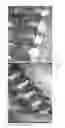 Fig. 09 - Pocket-enabled chip assembly for implantable devices