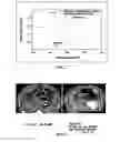 Fig. 02 - Stabilized gold nanoparticle and contrast agent