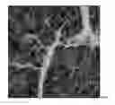 Fig. 04 - Crosslinked hyaluronic acid in emulsion