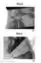 Fig. 03 - Negative electrode material for nonaqueous electrolyte secondary battery