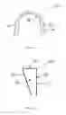 Fig. 02 - Dental appliance