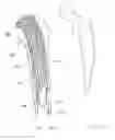 Fig. 09 - Method for enlarging a jaw bone using a hollow dental implant having a side perforation
