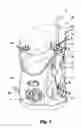 Fig. 02 - Adjustable flow regulator for dental water jet