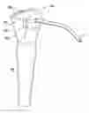 Fig. 01 - Dental syringe