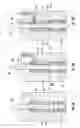 Fig. 06 - Dental syringe