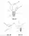 Fig. 09 - DEVICE FOR LOOSENING OR EXTRACTING A WISDOM TOOTH