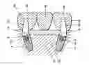 Fig. 01 - Set of one-piece angled abutments