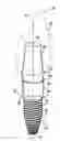Fig. 01 - Dental implant assembly