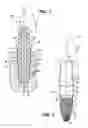 Fig. 02 - Dental implant assembly