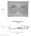Fig. 09 - SOLID-FLUID COMPOSITION AND USES THEREOF