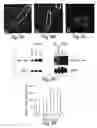 Fig. 09 - Methods for treating congestive heart failure