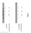 Fig. 07 - Enterostatin as Therapeutic Agent for Hypoglycemia