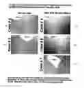 Fig. 01 - PROGNOSTIC TESTS FOR DEVELOPMENT OF DERMAL STRETCH MARKS AND IMPLICATIONS FOR THE PREVENTATIVE TREATMENT THEREOF