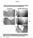 Fig. 02 - PROGNOSTIC TESTS FOR DEVELOPMENT OF DERMAL STRETCH MARKS AND IMPLICATIONS FOR THE PREVENTATIVE TREATMENT THEREOF