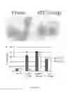 Fig. 02 - Myeloid differentiation inducing agents