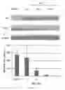 Fig. 06 - Myeloid differentiation inducing agents