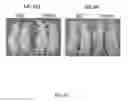 Fig. 11 - Myeloid differentiation inducing agents