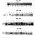 Fig. 08 - Method of Decreasing Pro-ADAM10 Secretase and/or Beta Secretase Levels