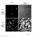 Fig. 06 - ACTIVATABLE DIAGNOSTIC AND THERAPEUTIC COMPOUND