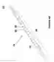 Fig. 07 - Brachytherapy fiducial needle fixation system and method
