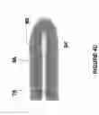 Fig. 08 - Brachytherapy fiducial needle fixation system and method