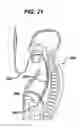 Fig. 08 - DEVICES AND METHODS FOR GUIDING SURGICAL INSTRUMENTS