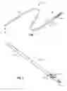 Fig. 02 - METHODS AND APPARATUS FOR ADVANCING A DEVICE FROM ONE BODY LUMEN TO ANOTHER