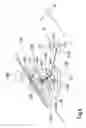 Fig. 07 - Speckle reduction of microwhite endoscopes