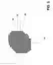 Fig. 04 - Verifying Lesion Characteristics Using Beam Shapes