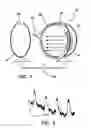 Fig. 02 - Method and apparatus for optogenetic treatment of blindness including retinitis pigmentosa