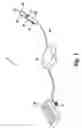 Fig. 02 - Method of treatment with multi-mode surgical tool