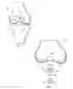 Fig. 02 - Osteochondral implant fixation procedure and bone dilator used in same