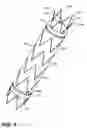 Fig. 03 - Stent Graft Restraining Mechanism for a Delivery System (Catheter)