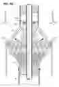 Fig. 07 - Stent Graft Restraining Mechanism for a Delivery System (Catheter)