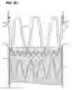 Fig. 09 - Stent Graft Restraining Mechanism for a Delivery System (Catheter)